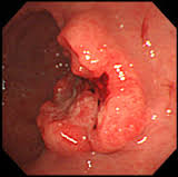 o0160015914046739863