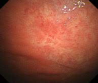 o0193016414046736865