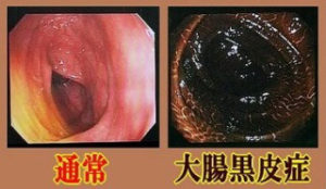 o0320018613670748802