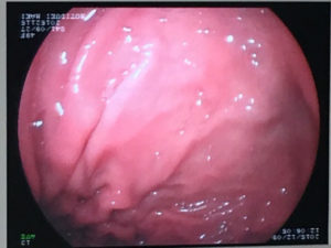 o0480036014046722172