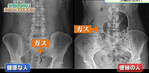 o0480023614055588057